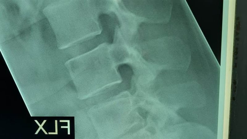 لقطة من الأشعة