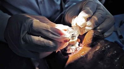 انطلاق المرحلة الثانية من مشروع 