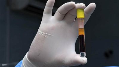 أستاذ فيروسات يكشف مفاجأة عن كورونا: لا توجد سلالة جديدة (فيديو)