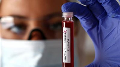 إيطاليا: 19 ألفا و978 إصابة جديدة بكورونا.. والإجمالي يقفز إلى 2.2 مليون حالة