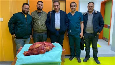 فريق طبي بمعهد جنوب مصر للأورام ينجح باستئصال ورم يزن 30 كجم