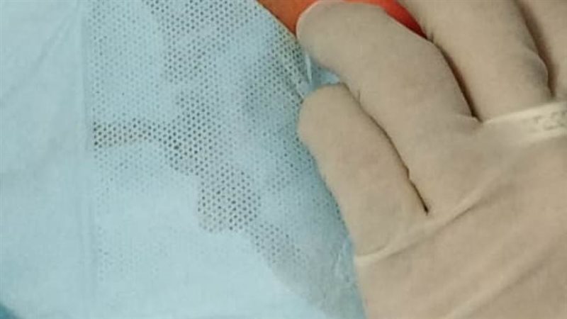 خلال الجراحة