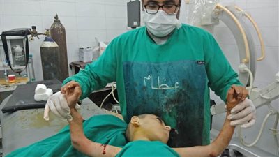  إصلاح الطرفيين العلويين لطفل مصاب بالعظم الزجاجي