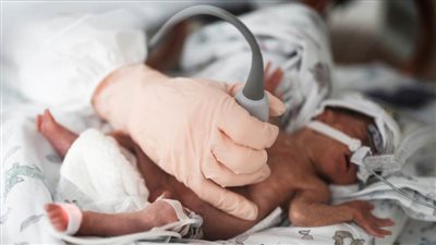 بلغاريا: ولادة طفل يحمل أجساما مضادة لكورونا