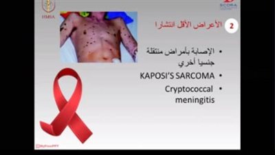 جامعة حلوان تصحح المفاهيم عن 