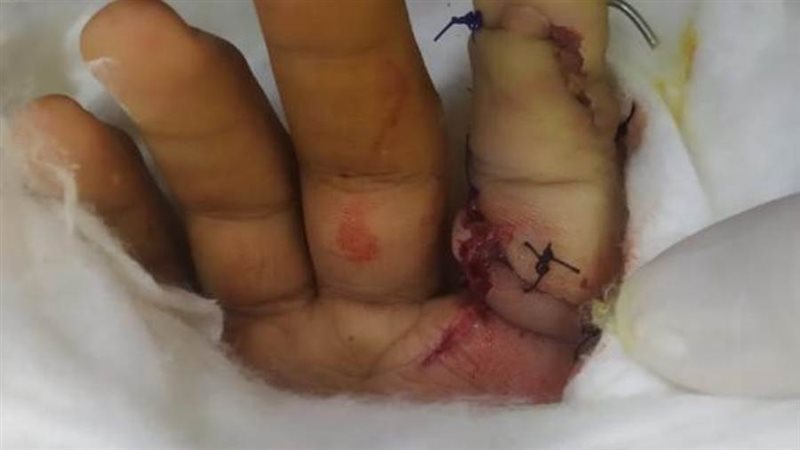 الجراحة الدقيقة