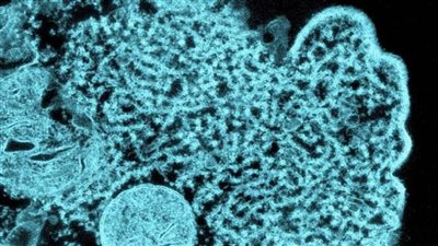 استشاري يكشف أعراض الإصابة بفيروس نيباه الصيني.. (فيديو)