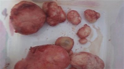 دخول ٧٦٢ مريضًا.. وإجراء ٣٥٢ جراحة بمستشفى 