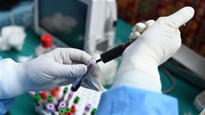  تونس تسجل 667 إصابة جديدة بكورونا