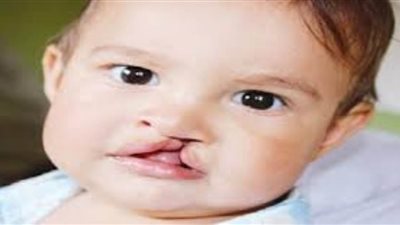 دراسة طبية: 