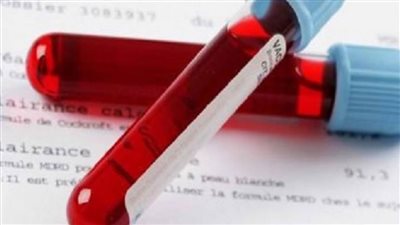 تطوير اختبار دم للتنبؤ بفرص رفض الجسم للكُلى الجديدة