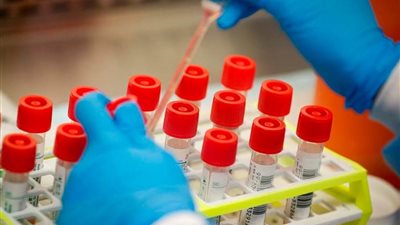 المغرب تسجل 431 إصابة جديدة بفيروس كورونا