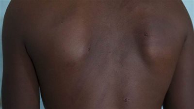 جرائم تطهير عرقي.. تمزيق مهابل النساء وإجبار الآباء على اغتصاب بنات تيجراي