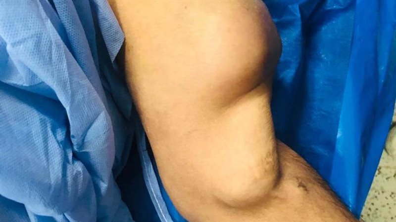 المريض قبل الجراحة