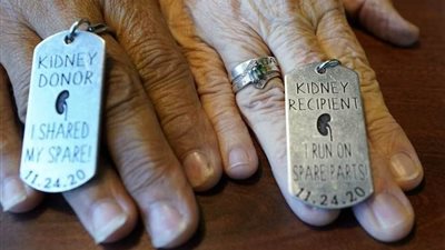  عاجل| تبرعت بكليتها لطليقة زوجها بعد يومين من الزواج 