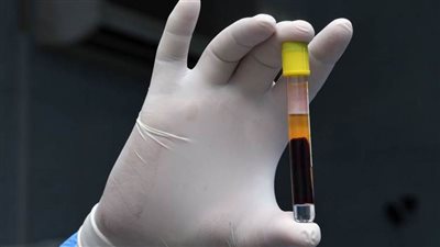 العراق يسجل 4157 إصابة جديدة بفيروس كورونا