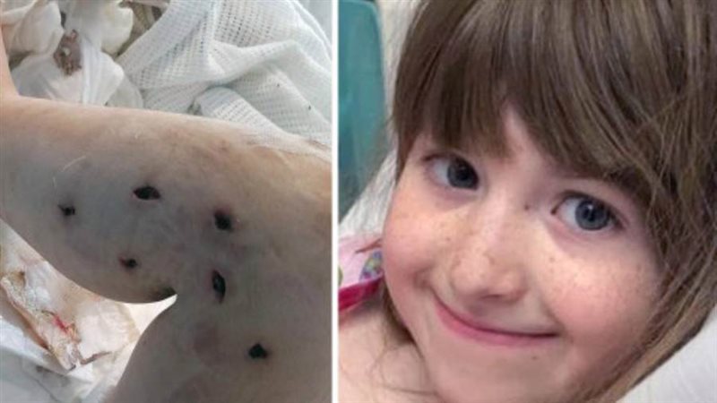 الطفلة أنابيل