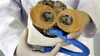 طبيب يفجر مفاجأة: 0.1% نسبة مخاطر الاعتماد على القلب الصناعي 