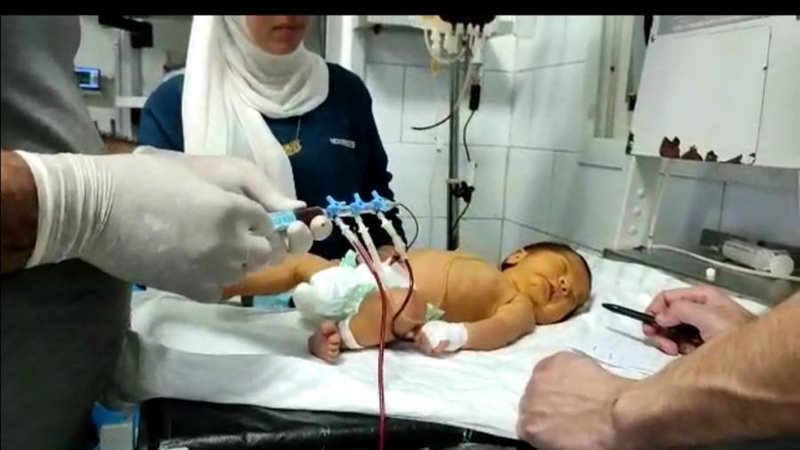 إجراء الجراحة للطفل