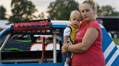 دراسة: أطفال الأمهات البدينات أكثر عرضة للإصابة بمرض الكبد الدهني