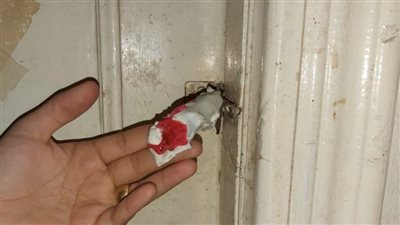 غلق مراكز خاصة للغسيل الكلوى مخالفة ببنى سويف 