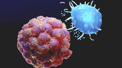 دراسة حديثة: الخلايا السرطانية تأكل نفسها للبقاء على قيد الحياة