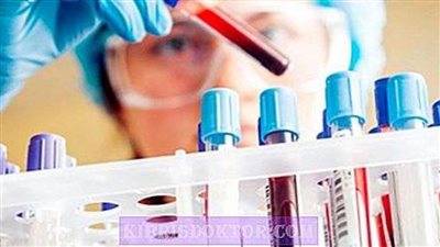 دراسة بلجيكية: هرمون 