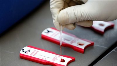 بولندا تعلن رصد 153 إصابة بسلالة 