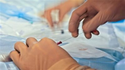 صحة كفر الشيخ: إجراء أكثر من 350 قسطرة قلبية