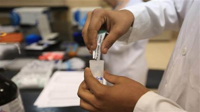 الزراعة: المركزي للمبيدات يواصل استلام عينات الصادرات الزراعية طوال إجازة عيد الأضحى