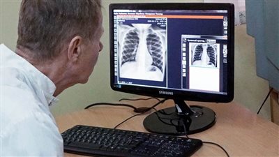   باحثون بالجامعة المصرية اليابانية يطورون جهاز (PCR) للكشف عن الإصابة بكورونا