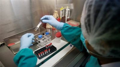 عاجل.. إصابة 2 مليار شخص بالسل والوباء يهدد العالم