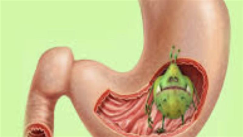 جرثومة المعدة - أرشيفية