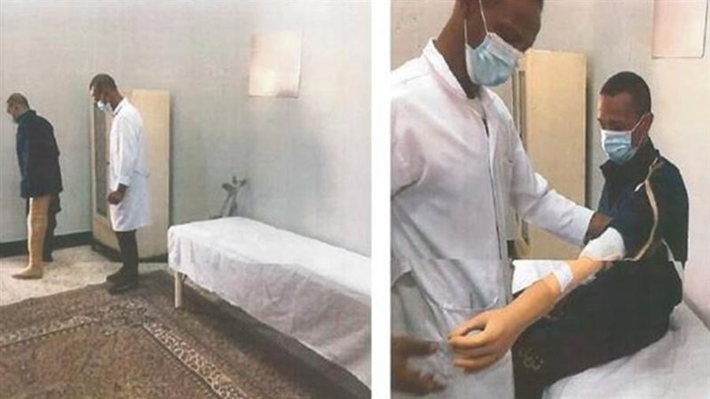 أطراف صناعية لعدد