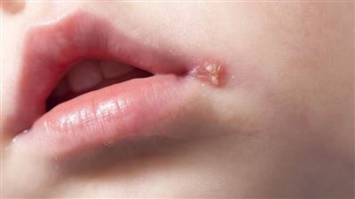 أخصائي أطفال يصف لـ