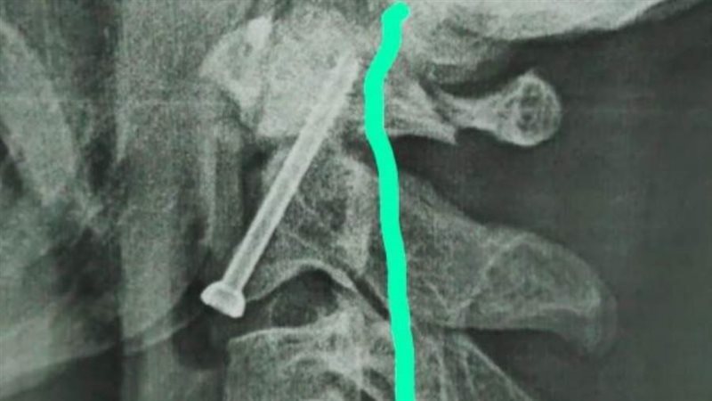 صرح أشعة المريض