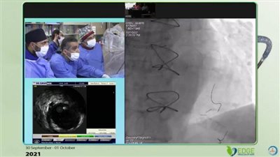 استشاري قلب بالرعاية الصحية ينجح في إجراء قسطرة معقدة في مؤتمر بإسطنبول