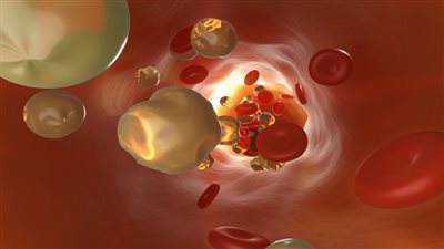 خمس وجبات خفيفة لتقليل خطر أعراض ارتفاع الكوليسترول