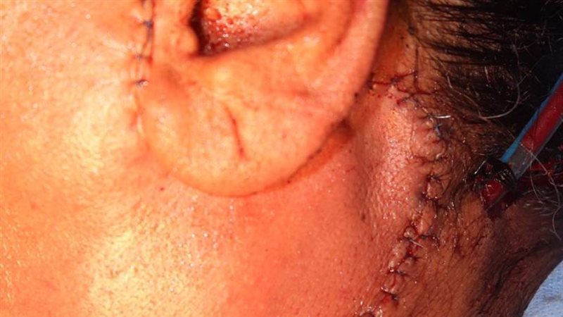 إحدى الجراحات