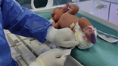 الرعاية الصحية تشارك بـ10 مستشفيات في الكشف عن الأمراض الوراثية لحديثي الولادة