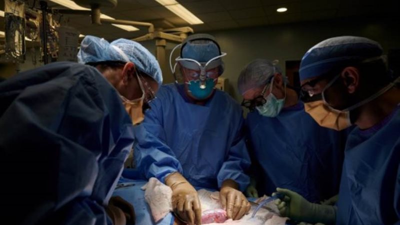 يقوم الفريق الجراحي