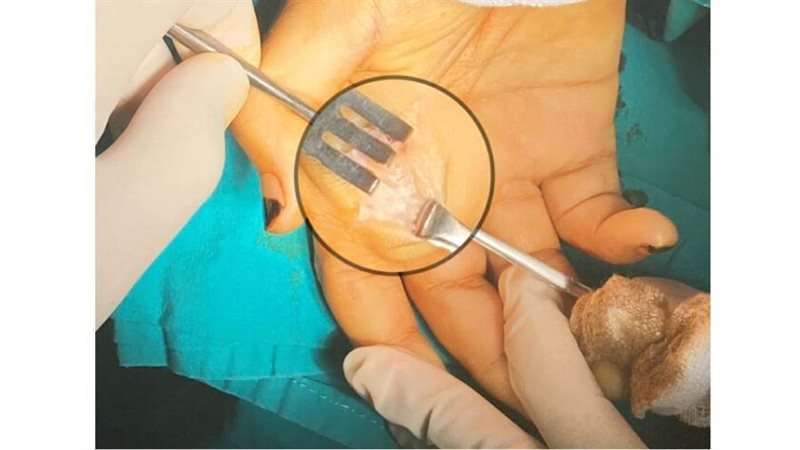 جراحات ميكروسكوبية