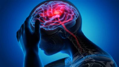 عاجل| طبيبة روسية تكشف العلامات الأولى للجلطة الدماغية