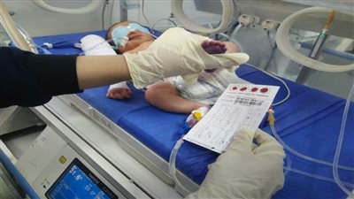 الصحة تعلن حصيلة فحص الأطفال المبتسرين خلال 4 أشهر