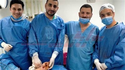بعد مرور ستة أشهر على إجراء الجراحة.. يد مبتورة تعود للحياة
