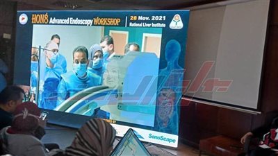 إجراء 16 عملية مناظير للجهاز الهضمي بمعهد الكبد القومي بالمنوفية 