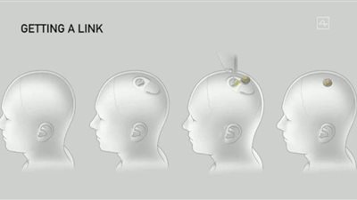 شركة إيلون ماسك للرقائق الدماغية تستعد لإجراء تجارب إكلينيكية على البشر