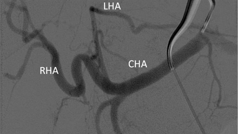 اشعة المريضة