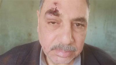 ولي أمر يتعدى على مشرف بمدرسة بشبين القناطر 