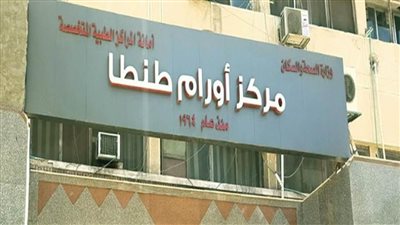 نجاح فريق طبي بمركز أورام طنطا في استئصال ورم سرطاني بالقولون السيني